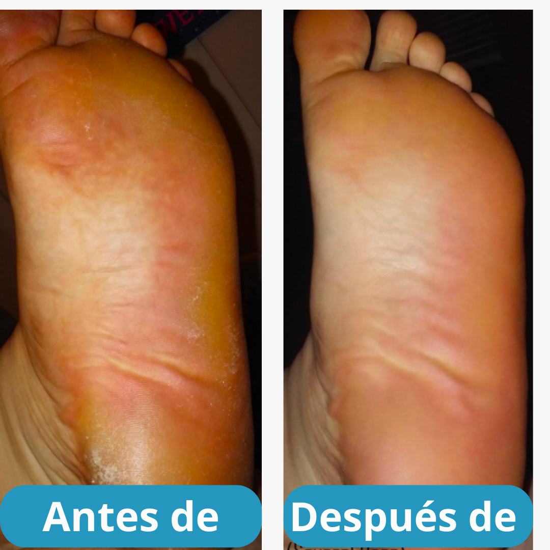 Sandalias ortopédicas