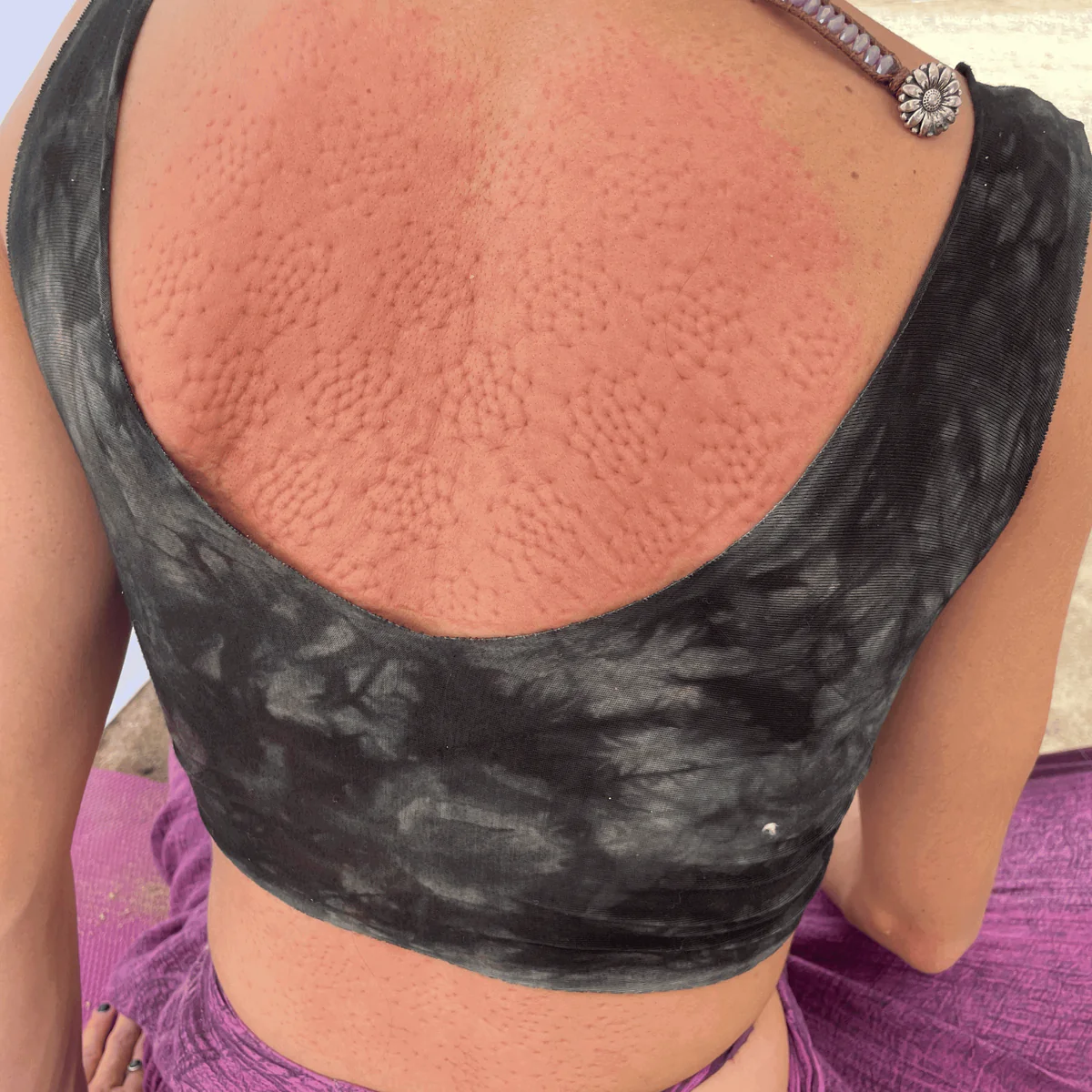 Postur Esterilla de acupresión